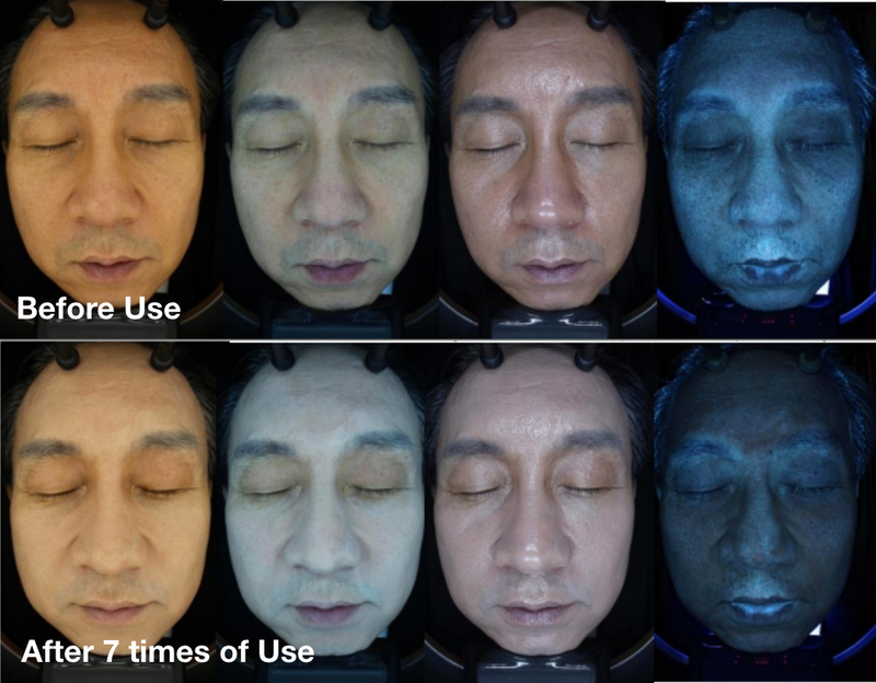 Clinical facial imaging comparing skin age indicators before use and after seven applications of a hydrogel mask